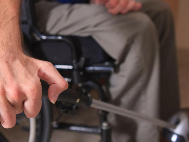 What is Ataxia?